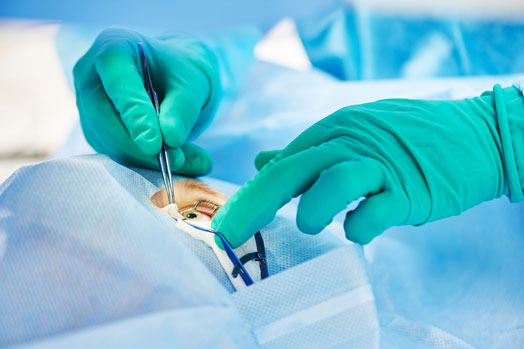 Doctor performing eye surgery