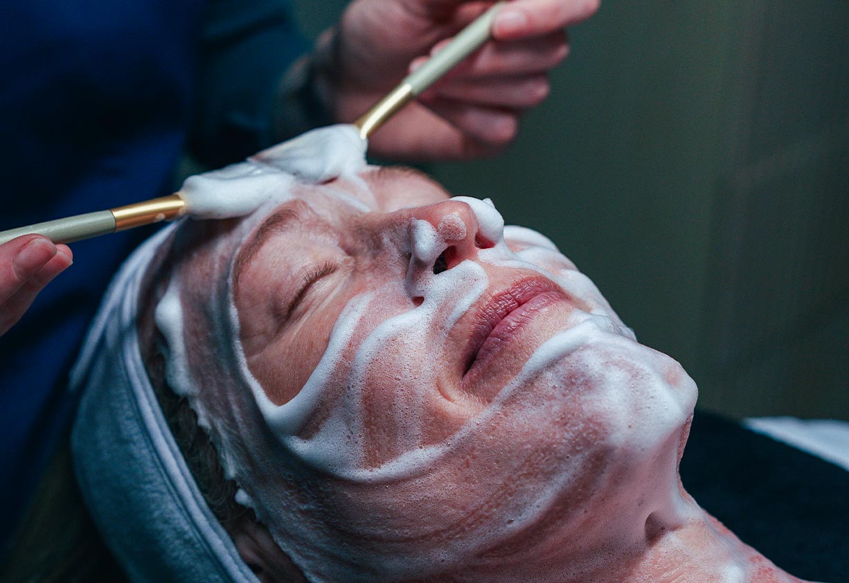 Glow Without the Downtime: Discover the RDS No-Peel Chemical Peel